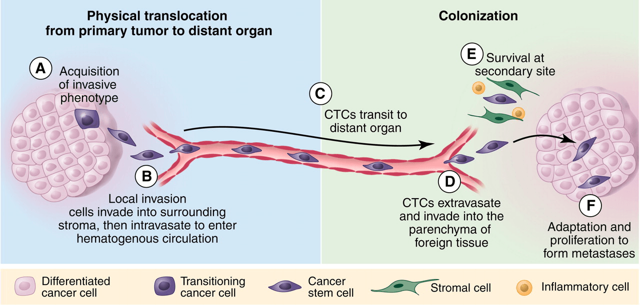 Circulating Tumor Cell (CTC) FISH